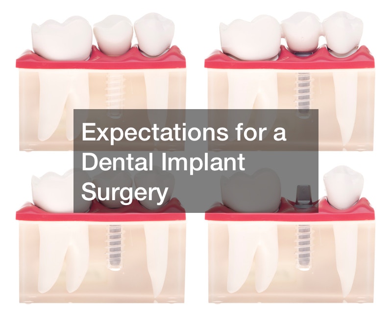 Expectations for a Dental Implant Surgery